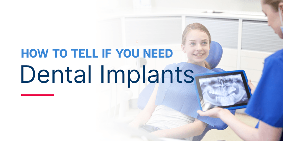 How to Tell If You Need Dental Implants