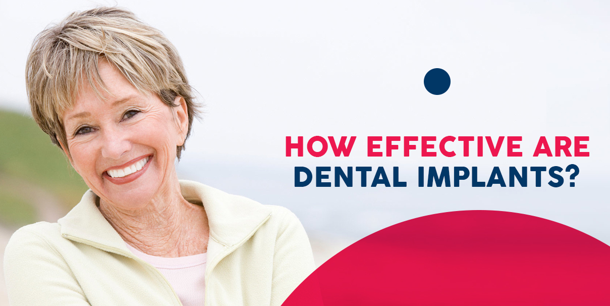 How Effective Are Dental Implants?